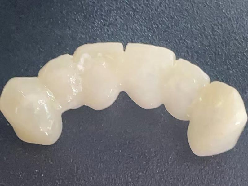 «Уақытша тәж» дегеніміз не? Неліктен сізге біреу керек?