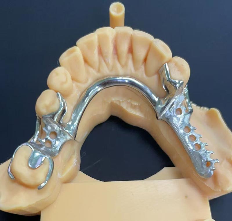 Кобальт-Хром Framework артықшылықтары (Co Cr Framework)