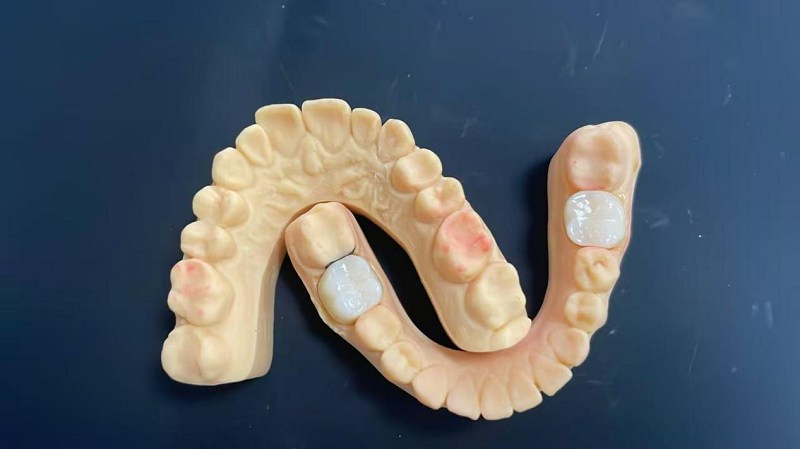 Иық шеті қандай?