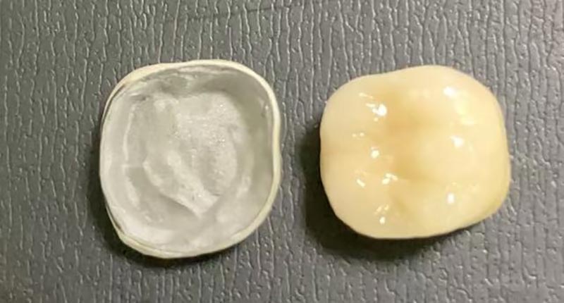 WM DENTAL LAB – Қытайдың жетекші стоматологиялық зертханасы