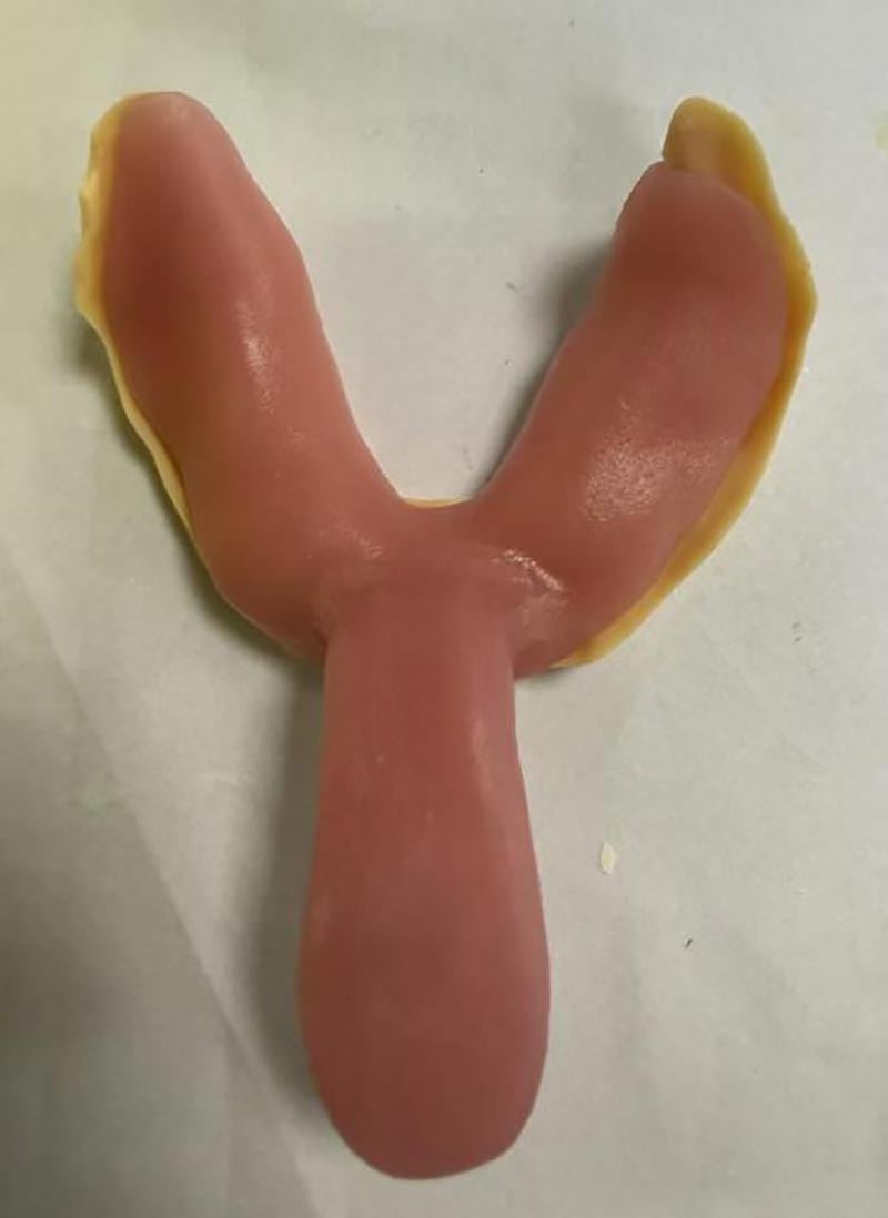 Арнайы стоматологиялық науалар туралы сіз білмеген нәрселер