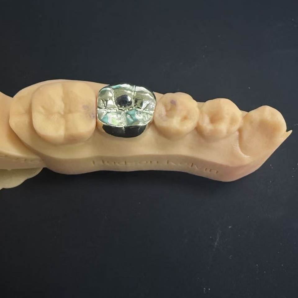 Алтын тәждер: өмір бойы тістерді қалпына келтіруге арналған қымбат металды таңдау