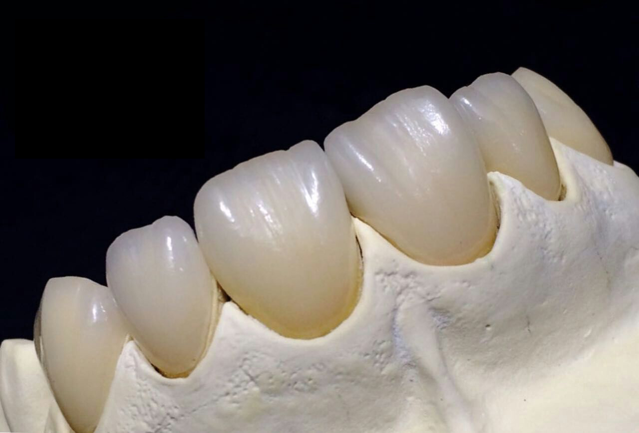 Толық Zirconia Crown Қытай стоматологиялық зертханасы