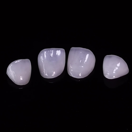 Hight Translucent Dental Veneer Layered Emax Veneer Стоматологиялық зертханалық жұмыс