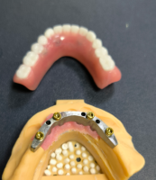 Локатор және стоматологиялық бар