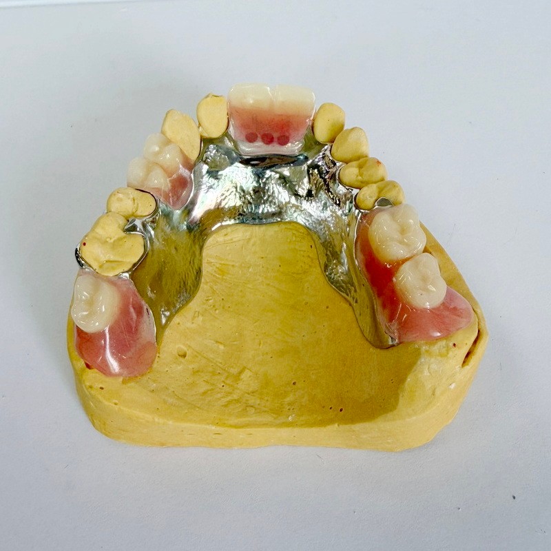 Алынбалы қалпына келтірудің ішінара жақтауы